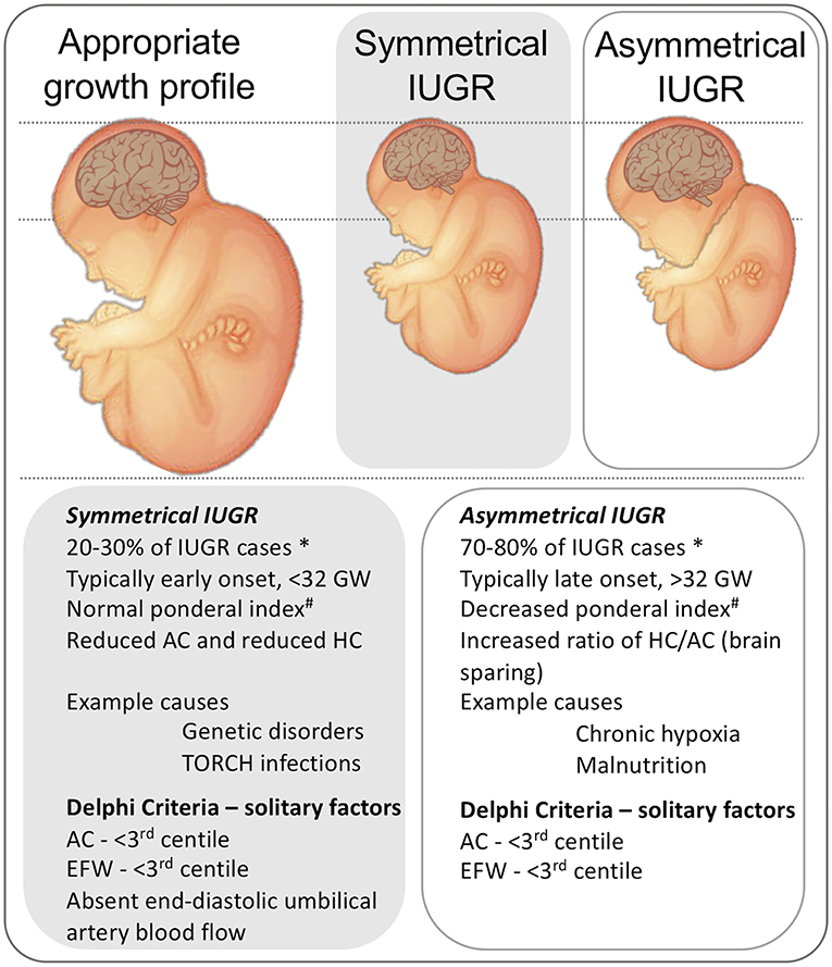 Iugr Baby Growth Chart