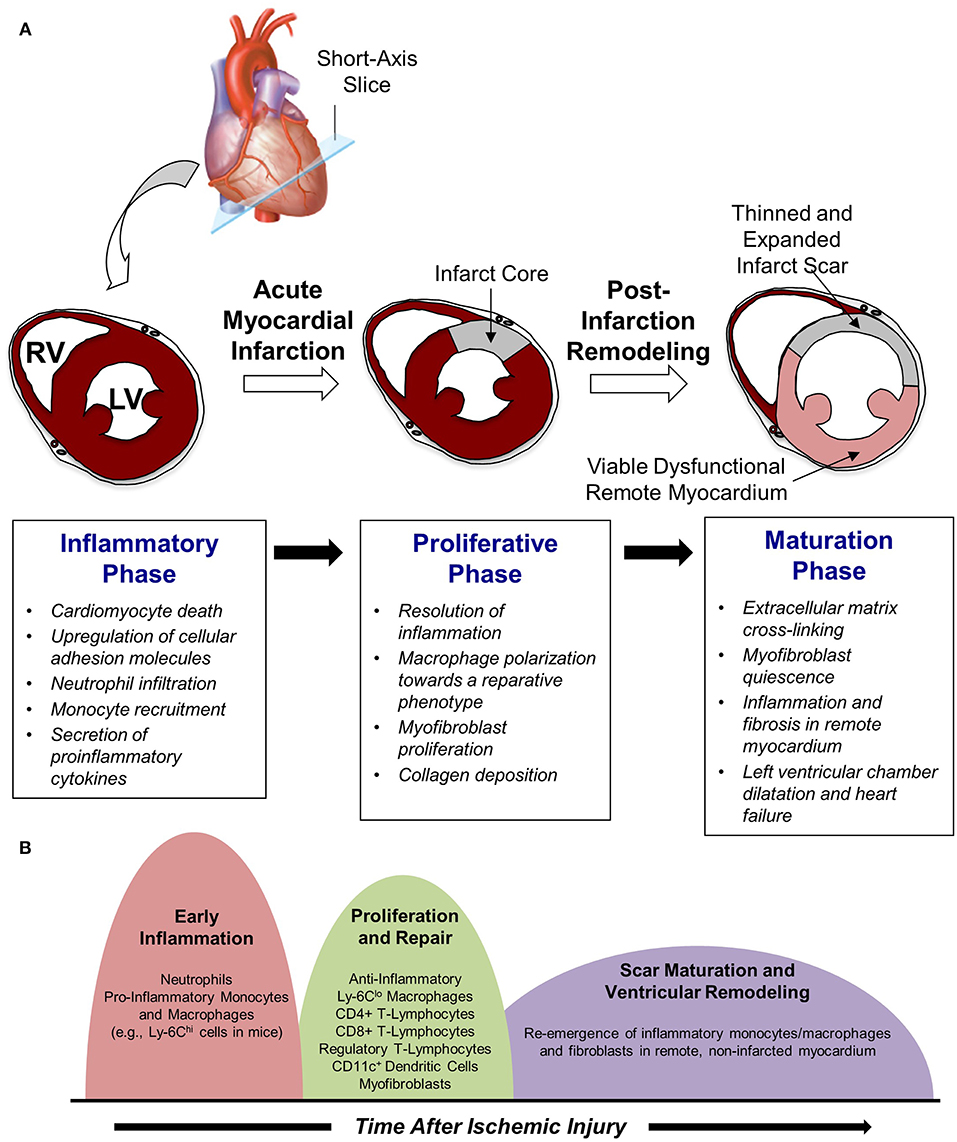 Frontiers Selectins And Immune Cells In Acute Myocardial Infarction