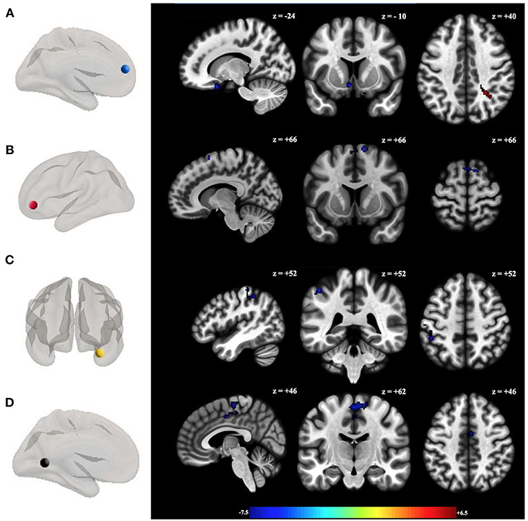 Key Brain Activity Absent in Borderline Personality Disorder - Neuroscience  News