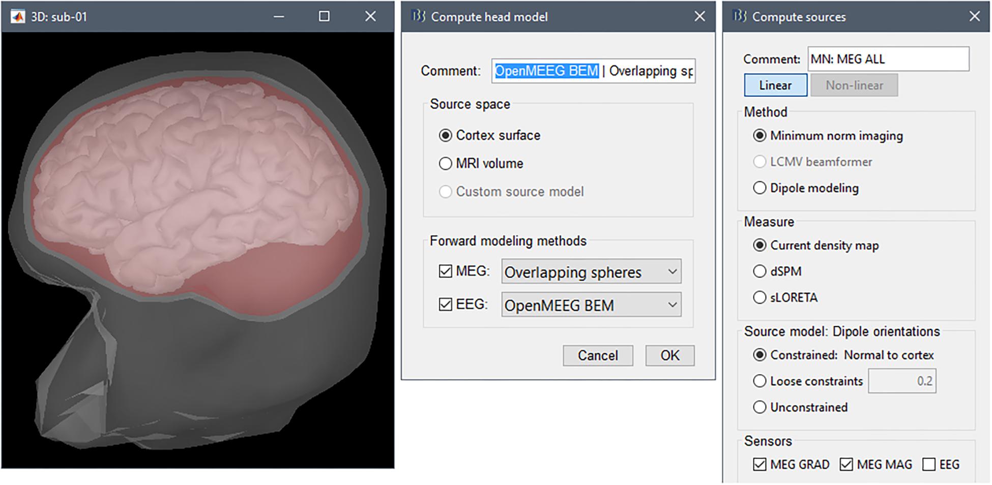 MEG-EEG Primer [ペーパーバック] Hari，Riitta，M.D.，Ph.D