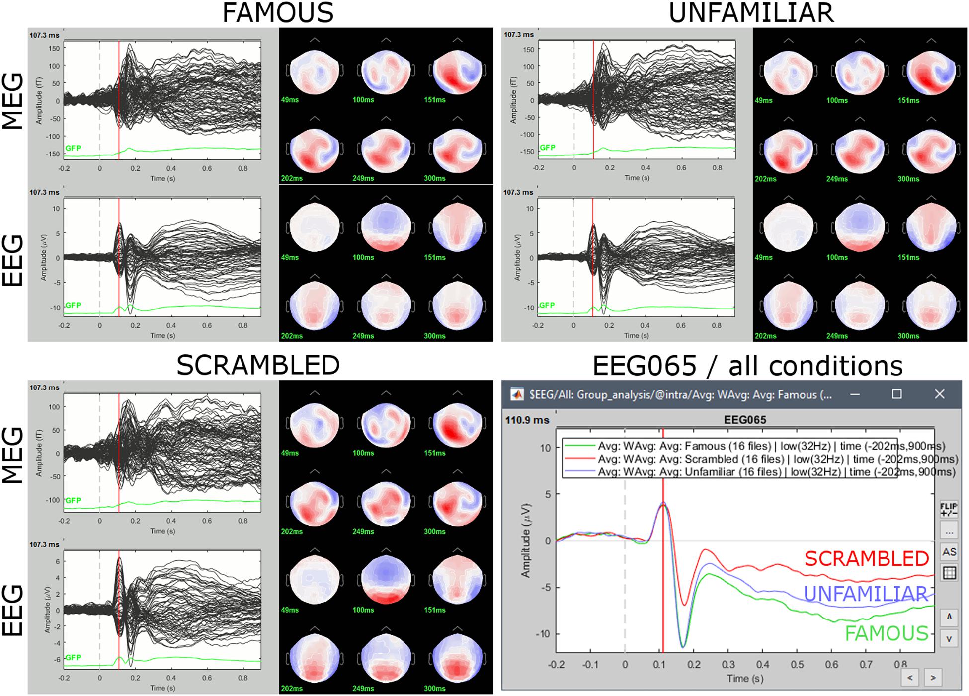 From raw MEG/EEG to publication: how to perform MEG/EEG