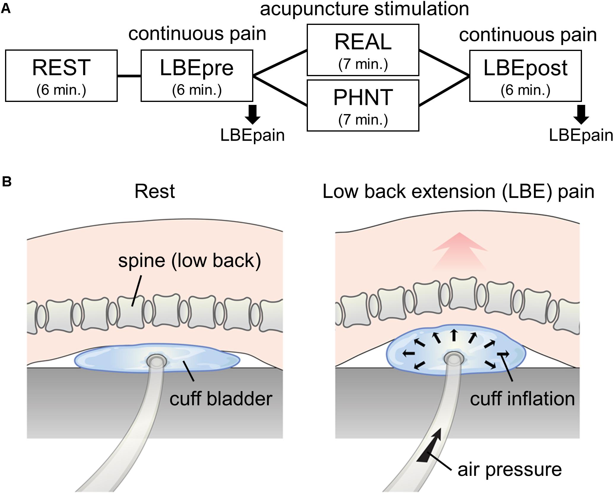 How effective is acupuncture for chronic back pain