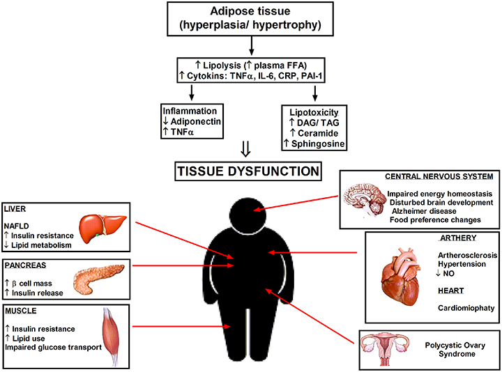 insulin resistance ncbi