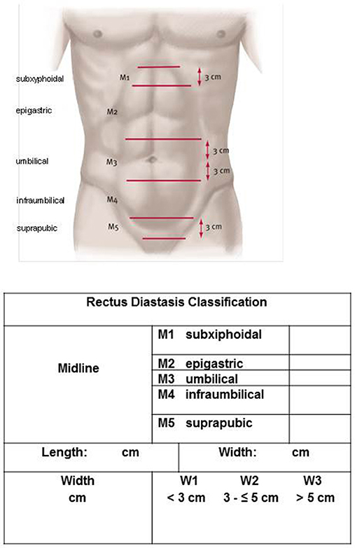 Frontiers  Classification of Rectus Diastasis—A Proposal by the German  Hernia Society (DHG) and the International Endohernia Society (IEHS)