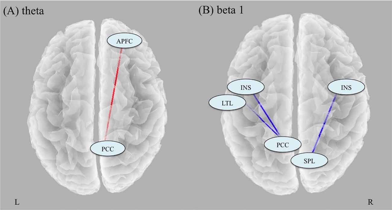 Changing the image problem of electroconvulsive therapy