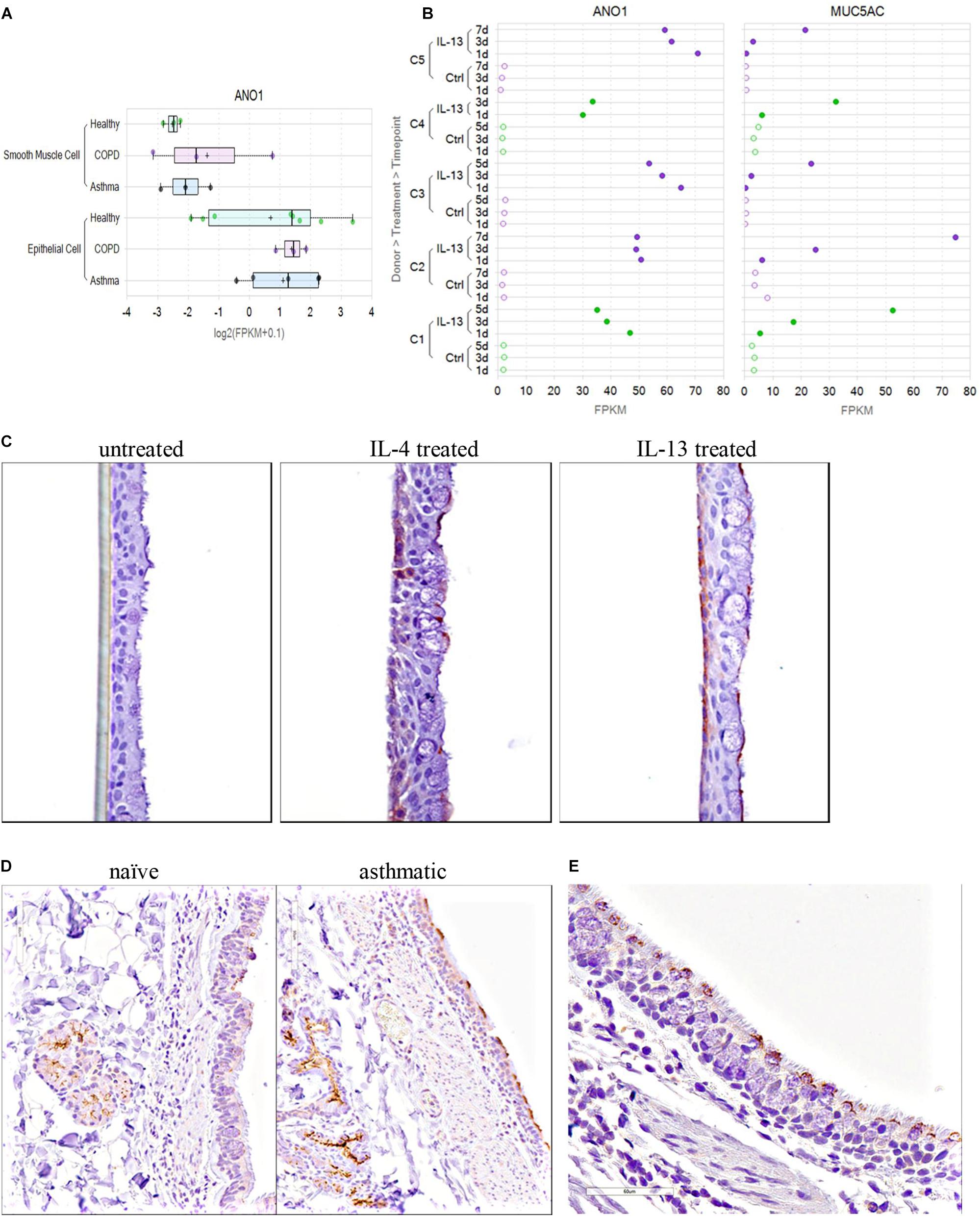 Frontiers | Drug Repurposing: The Anthelmintics Niclosamide Frontiers | Drug Repurposing: The Anthelmintics Niclosamide