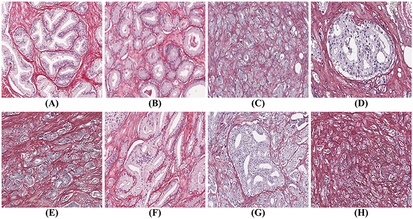 Normal Prostate Gland Histology