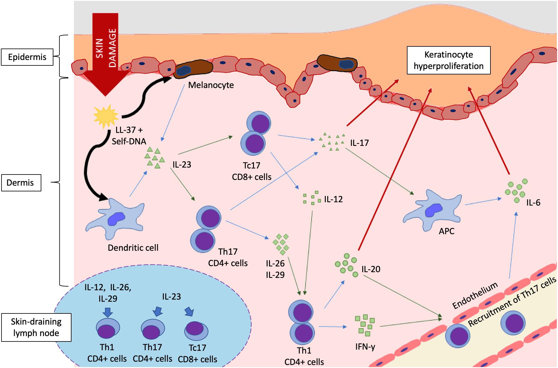 psoriasis pathology mechanism