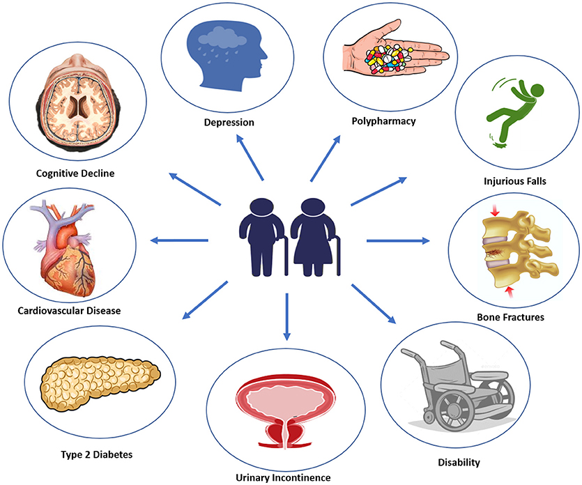 diabetes mellitus type 2 pubmed)