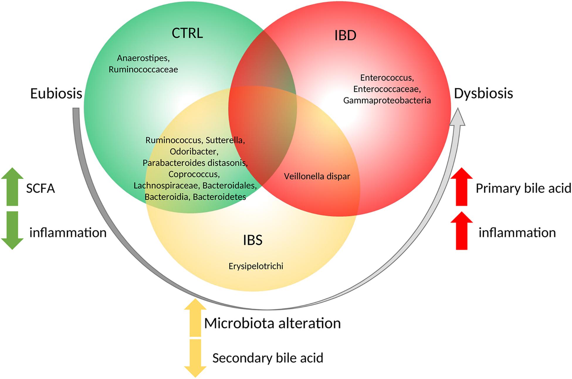 Ibs Vs Ibd Chart