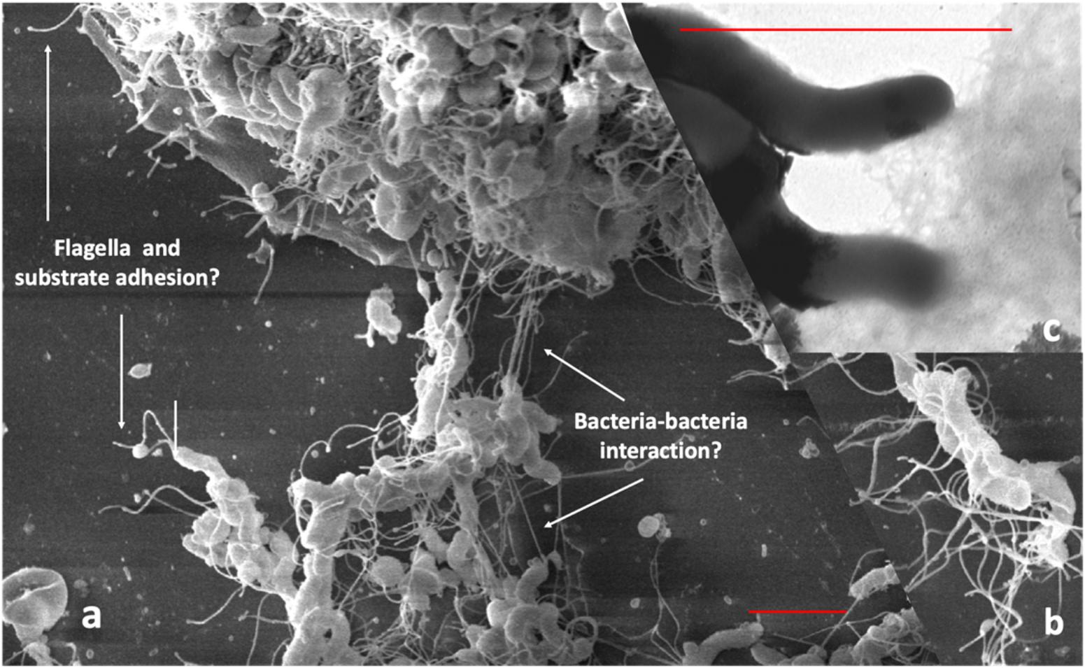 Infectia cu Helicobacter pylori: cauze, simptome, tratamente alopate si complementare | turismmiraslau.ro