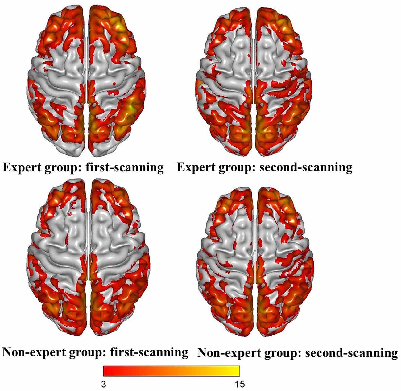 Frontiers  A Reduction in Video Gaming Time Produced a Decrease in Brain  Activity