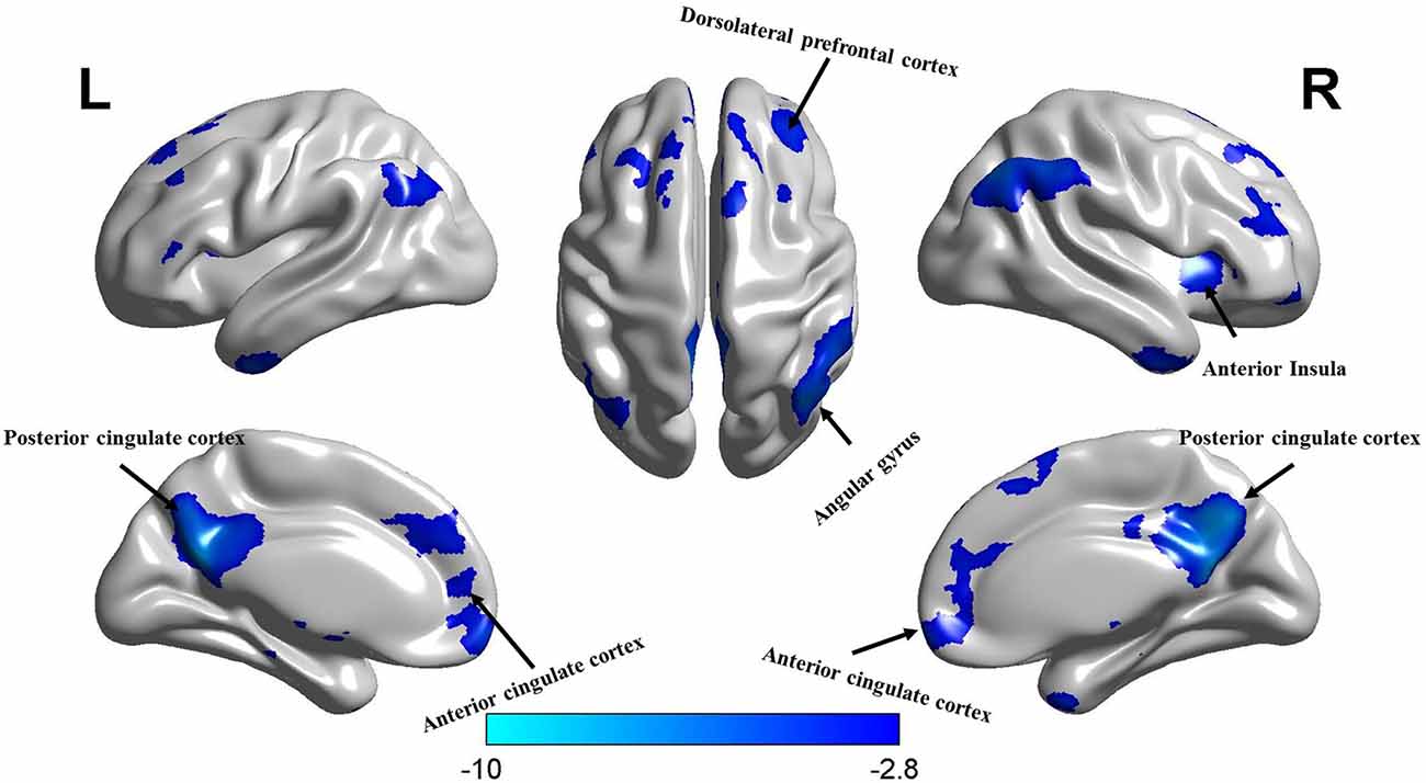 Video games will destroy your brain : r/neurology