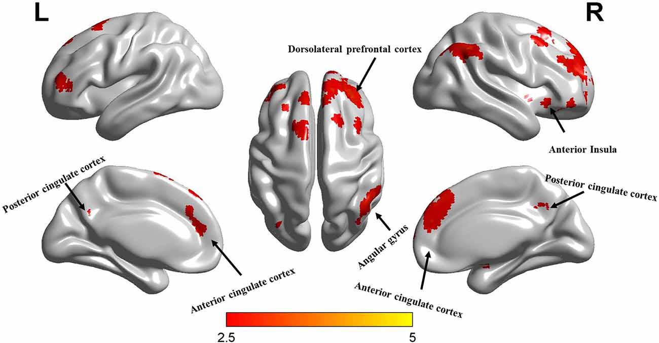 Video game brain damage: Study says FPS, ARPG games may cause