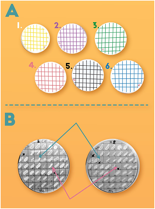 Figure 3 - (A) In our experiment, different P sources were present in each Petri dish, to test the ability of different kinds of bacteria to use the P contained in each source.