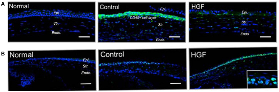 Frontiers Corneal Repair And Regeneration Current Concepts And Future Directions Bioengineering And Biotechnology