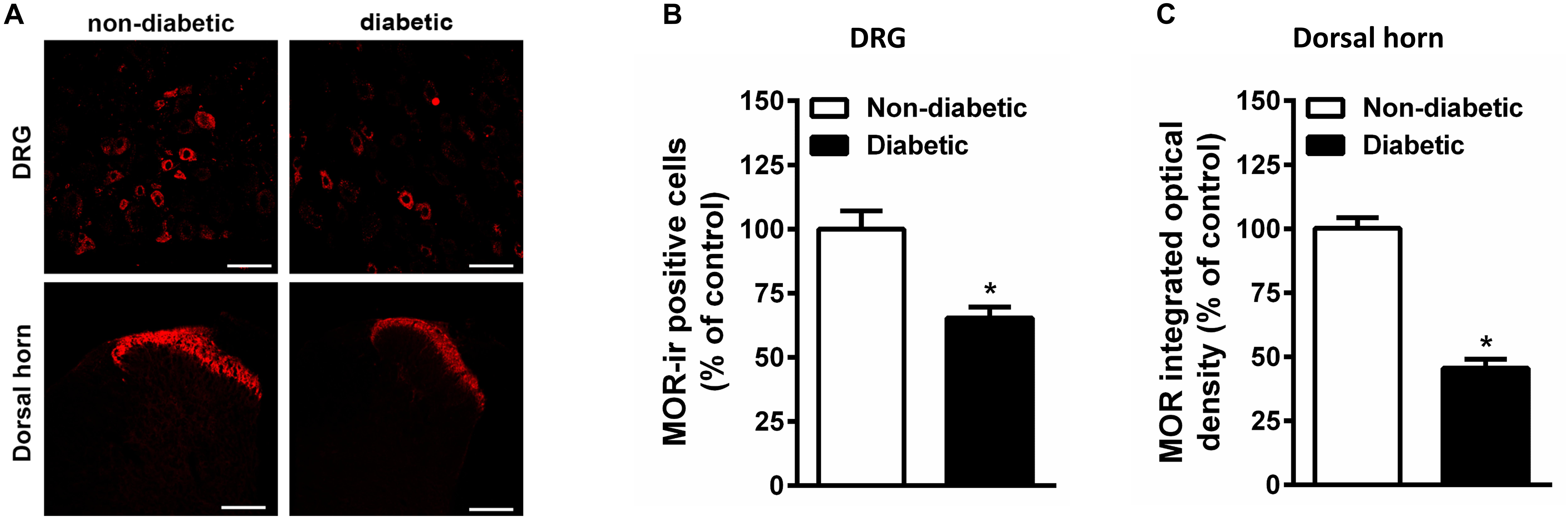 remission in type 1 diabetes mellitus
