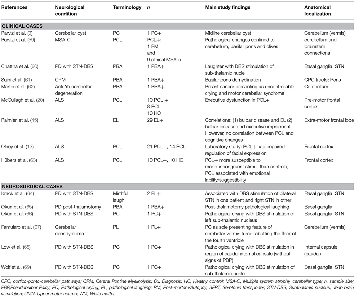 Pseudobulbar palsy