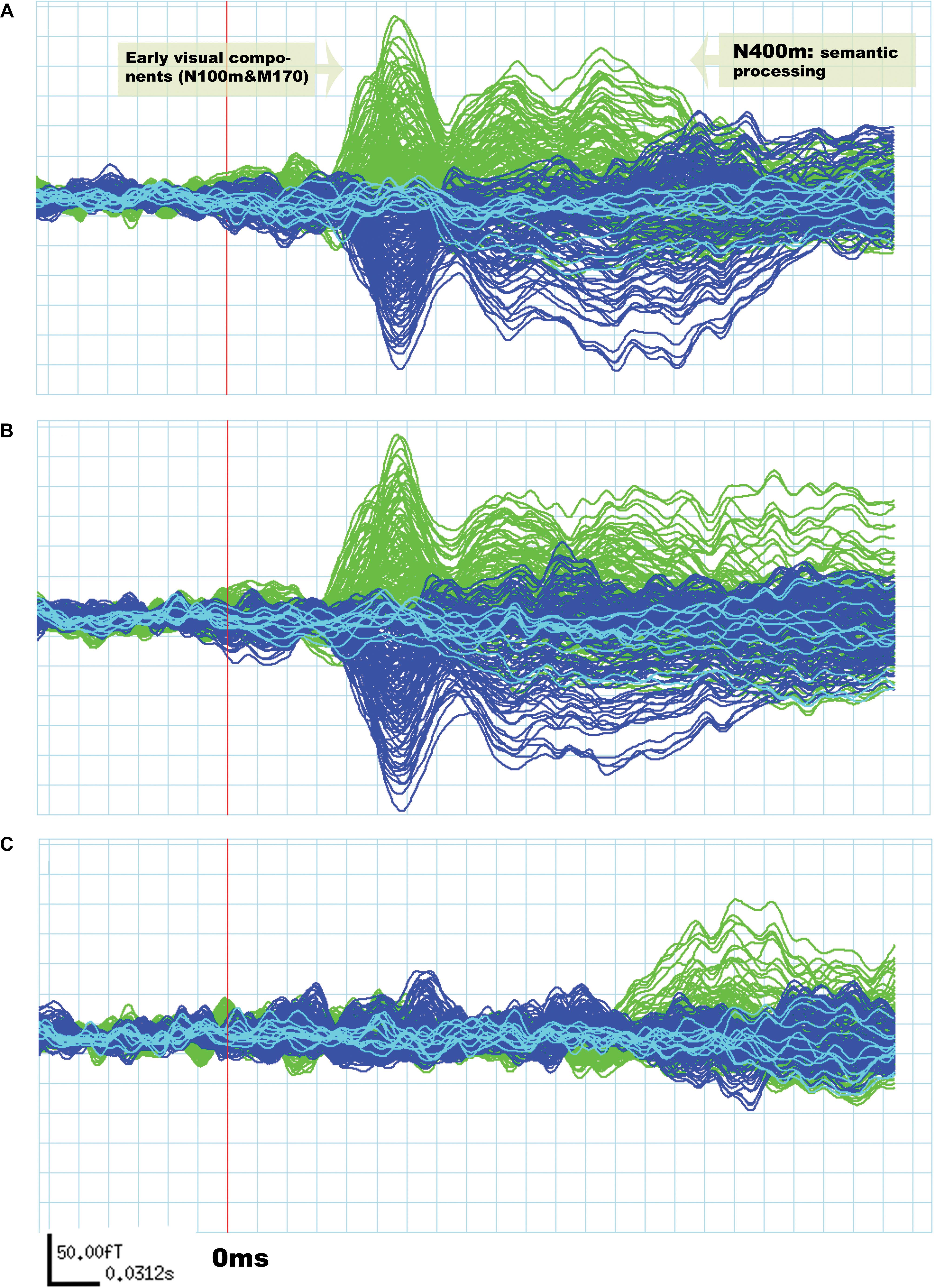 Frontiers Inferior Longitudinal Fasciculus Role In Visual Processing And Language Comprehension A Combined Meg Dti Study Neuroscience