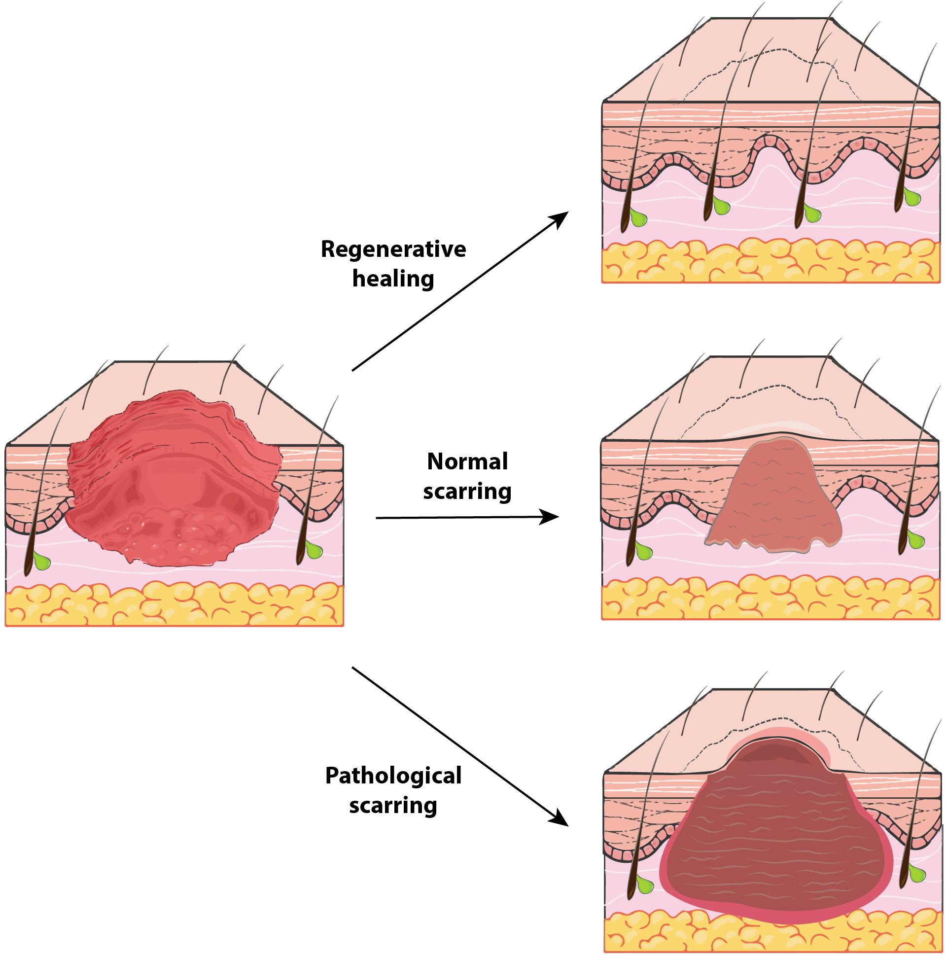 Frontiers | The Spectrum of Scarring in Craniofacial Wound Repair