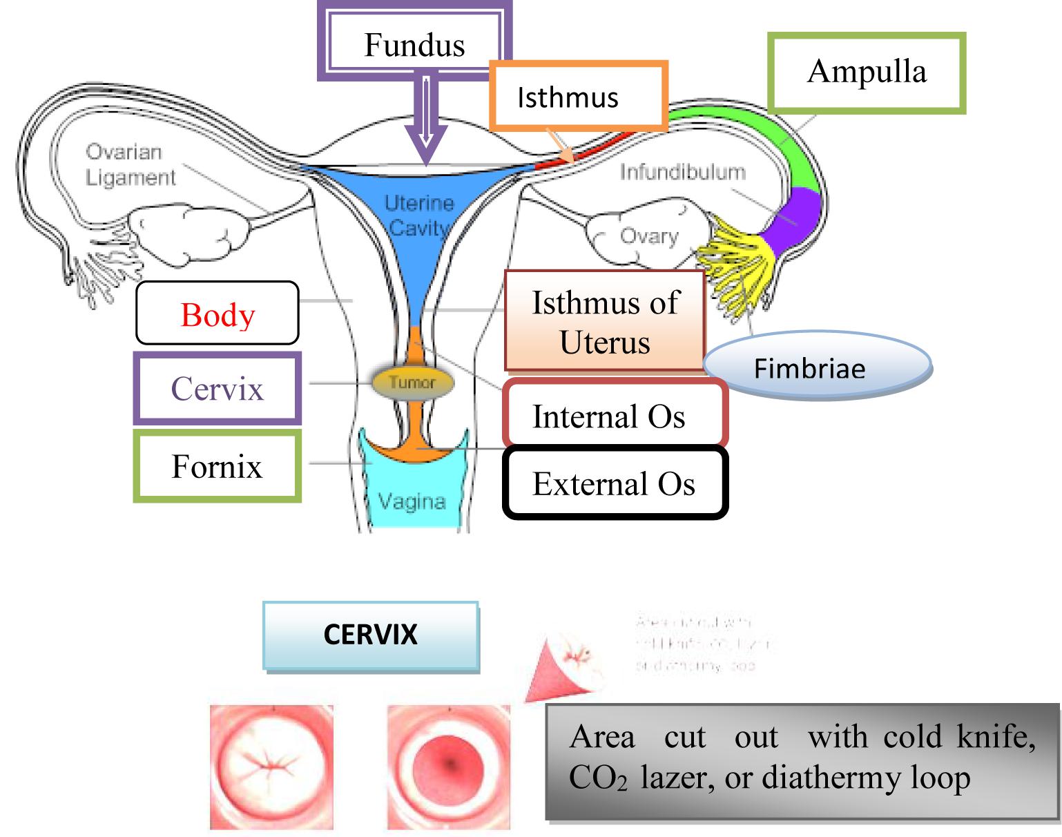 Pathogenesis Of Cervical Cancer