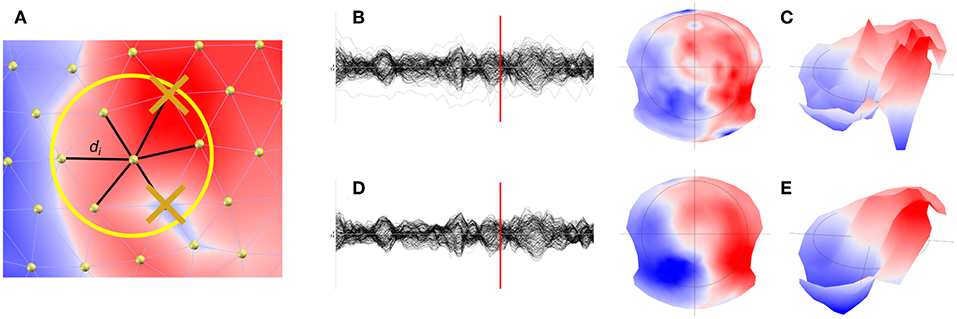 Electrical scalp map topographies (for each group, at the MMN