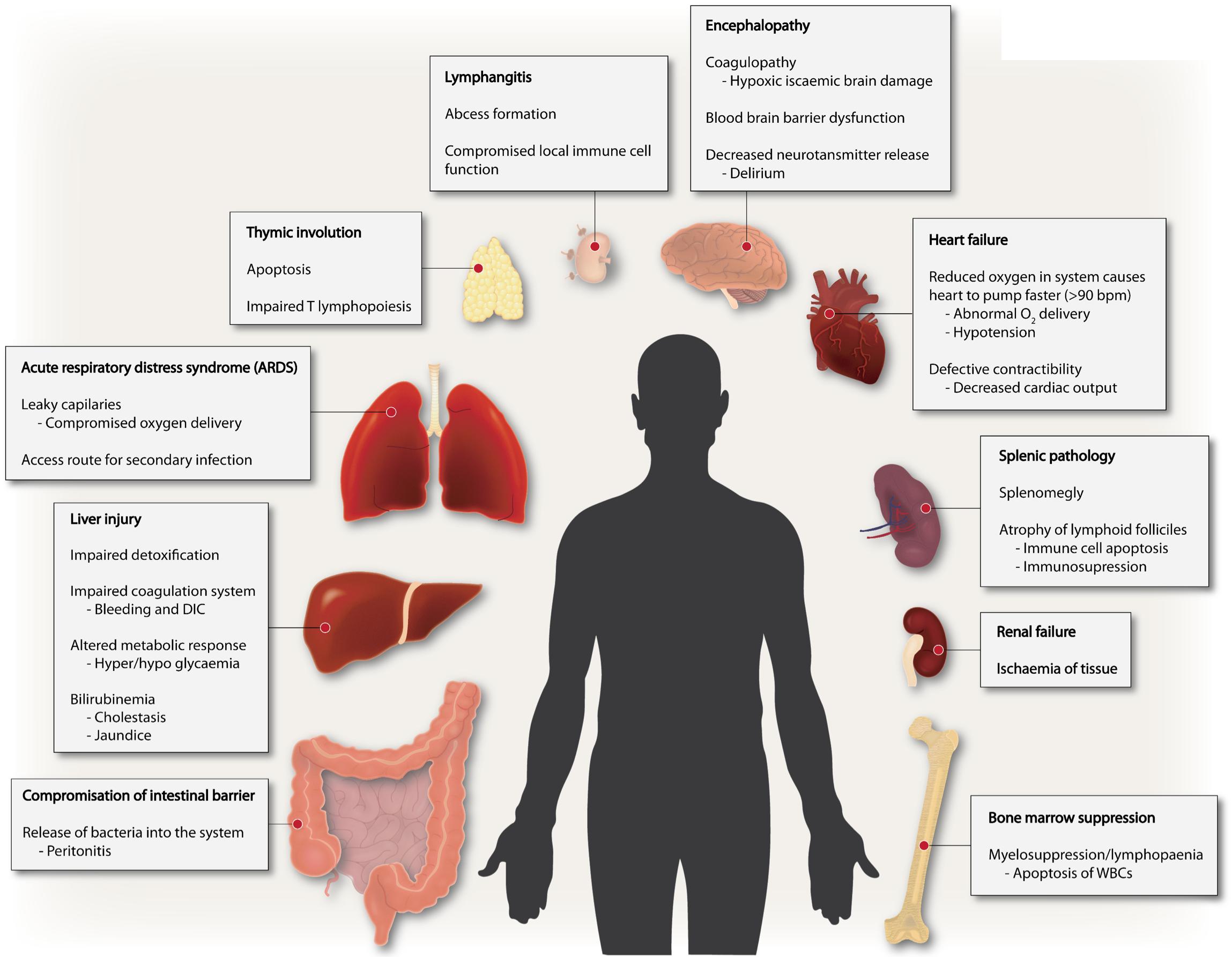 can-peritonitis-kill-you-slideshare