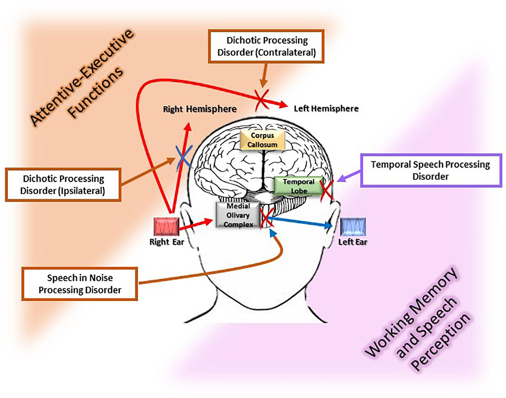 Frontiers  Hearing loss and its link to cognitive impairment and dementia