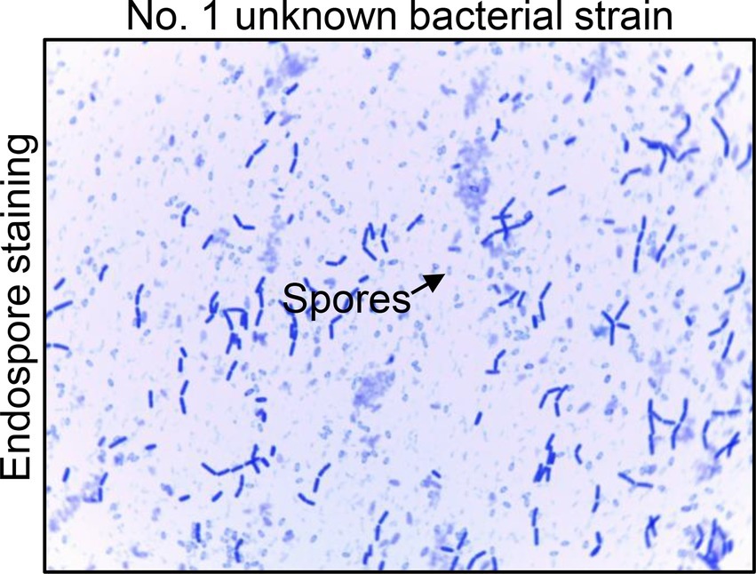 spore stain