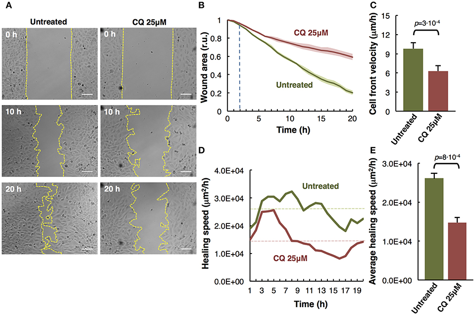 Frontiers In Vitro Cell Migration Invasion And Adhesion