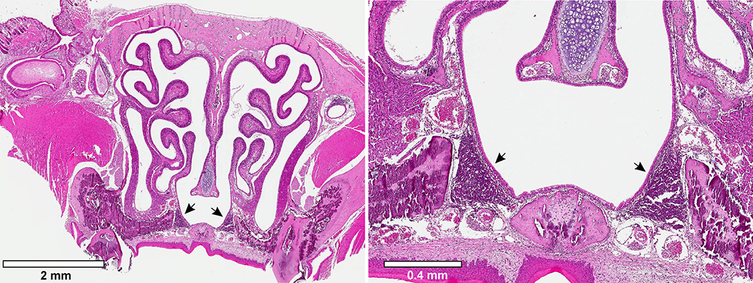 PDF) Streptococcus pyogenes evades adaptive immunity through