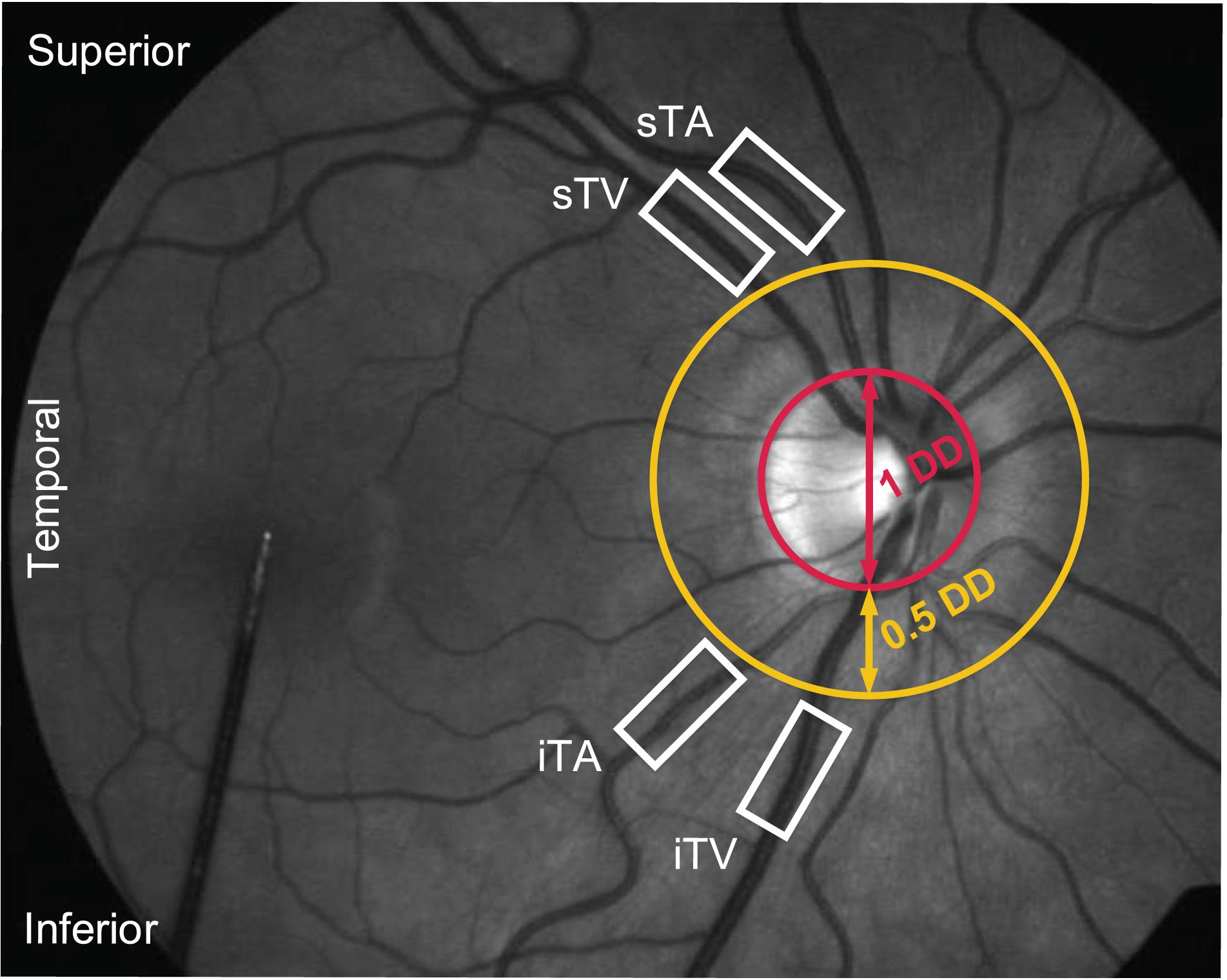 Frontiers  Retinal Vessel Responses to Flicker Stimulation Are