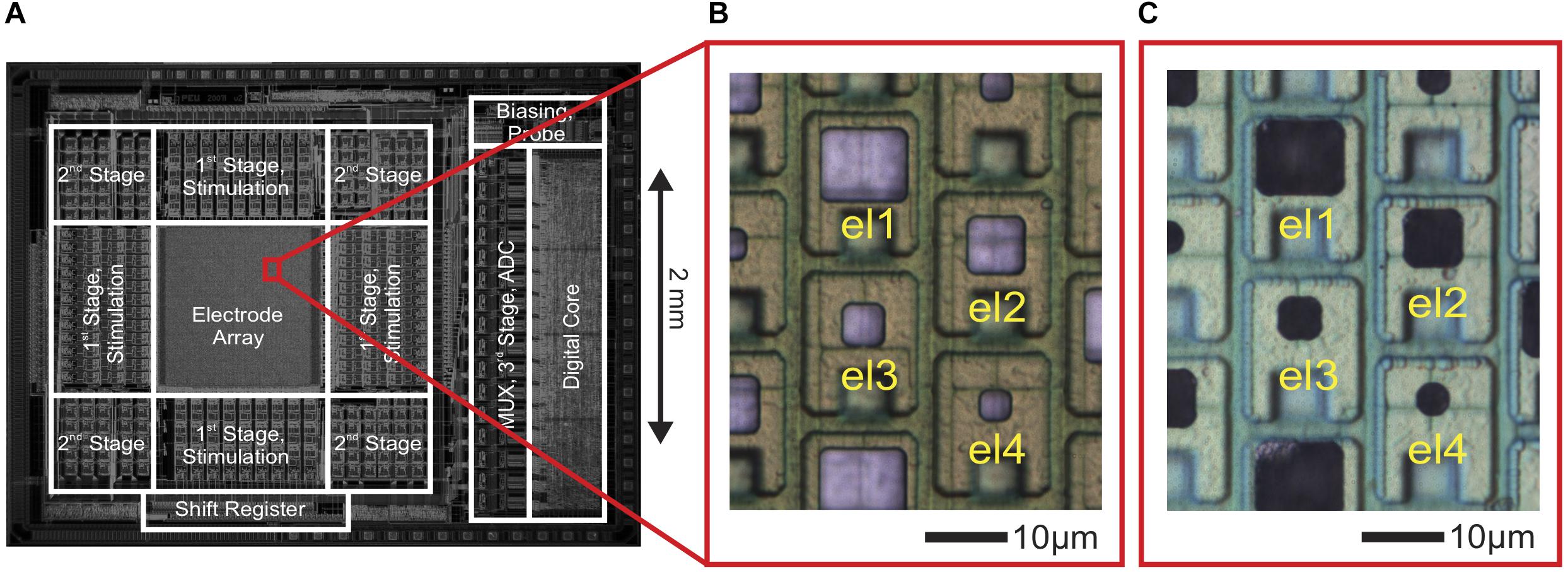 TENS Unit Placement 101: Insights into Effective Electrode Positioning