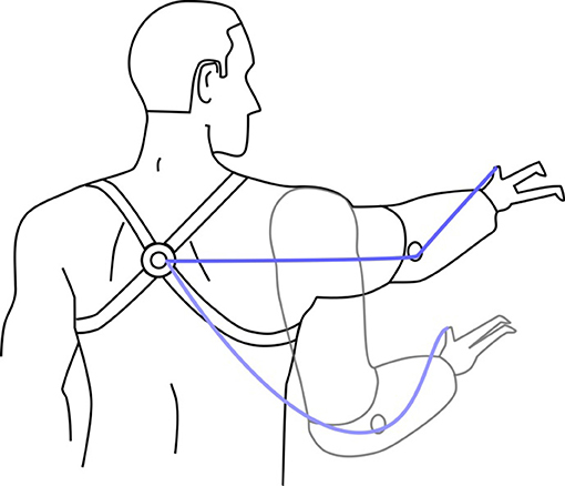 Figure 2 - Most body-powered prostheses can be opened by pulling on a cable, similar to brakes on a bicycle.