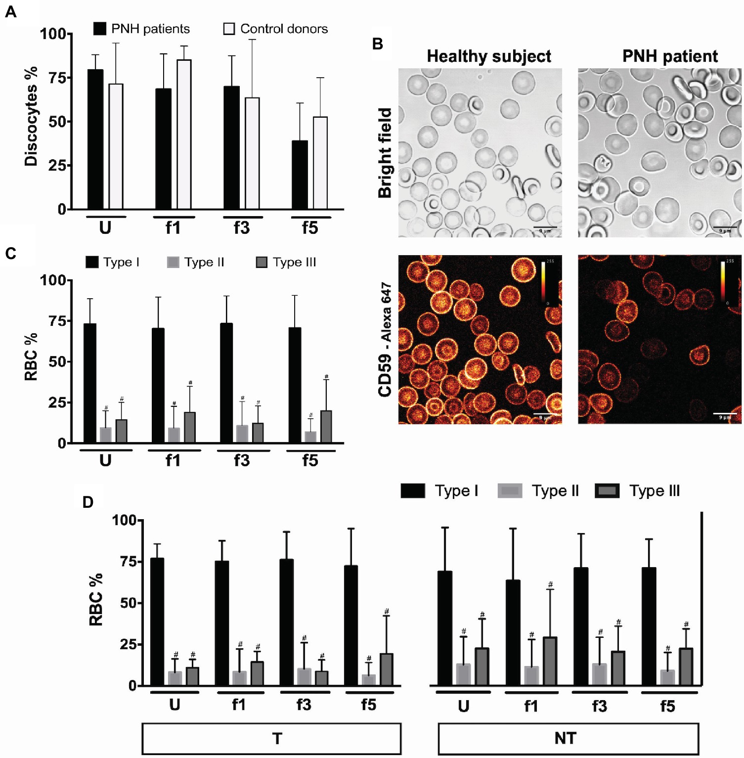 | Red Blood Cell Homeostasis and Altered Vesicle Formation in Patients With Paroxysmal Nocturnal