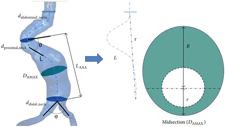 Main Geometrical Parameters For Naked Complex