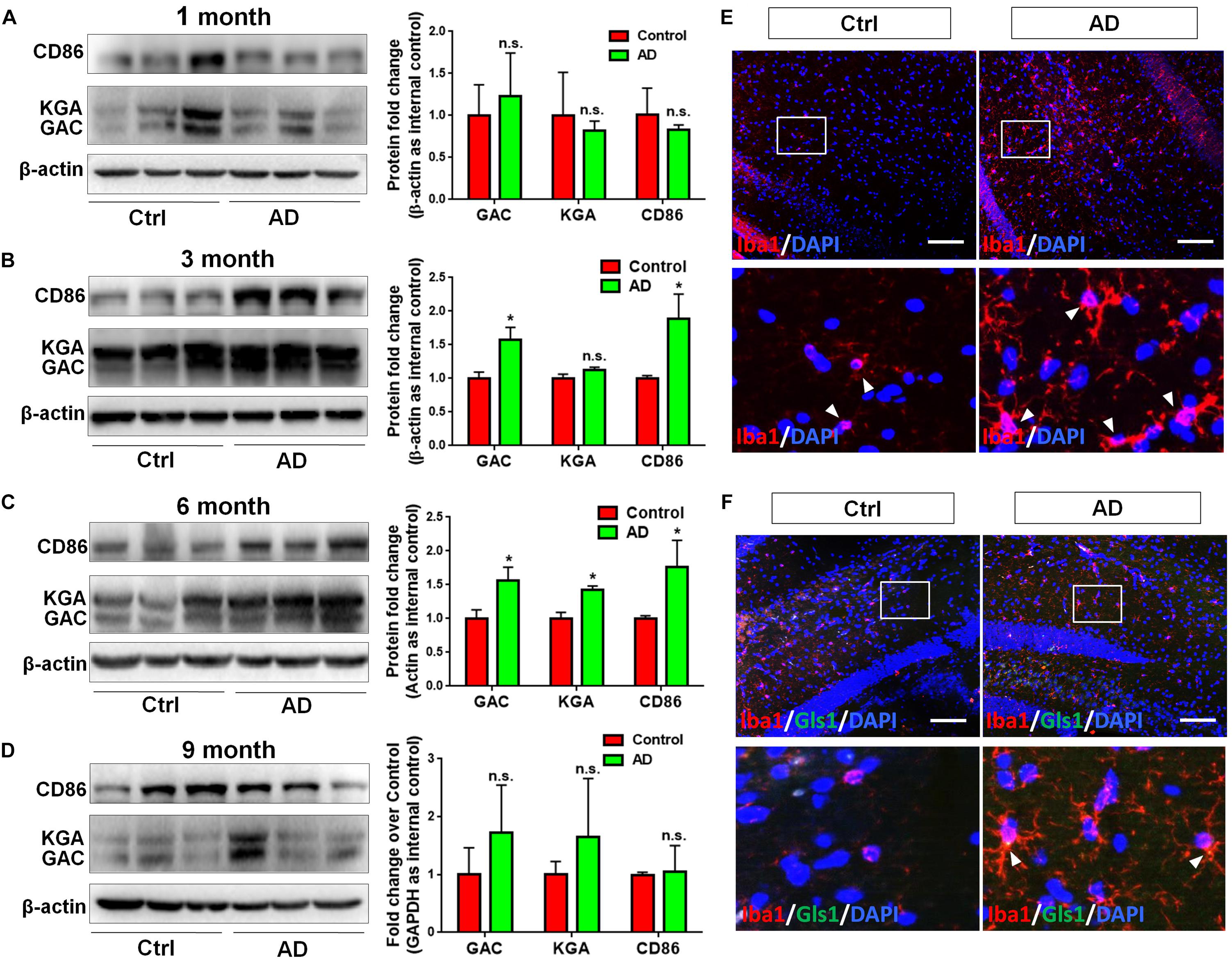 Frontiers Glutaminase C Regulates Microglial Activation And Pro Inflammatory Exosome Release Relevance To The Pathogenesis Of Alzheimer S Disease Cellular Neuroscience