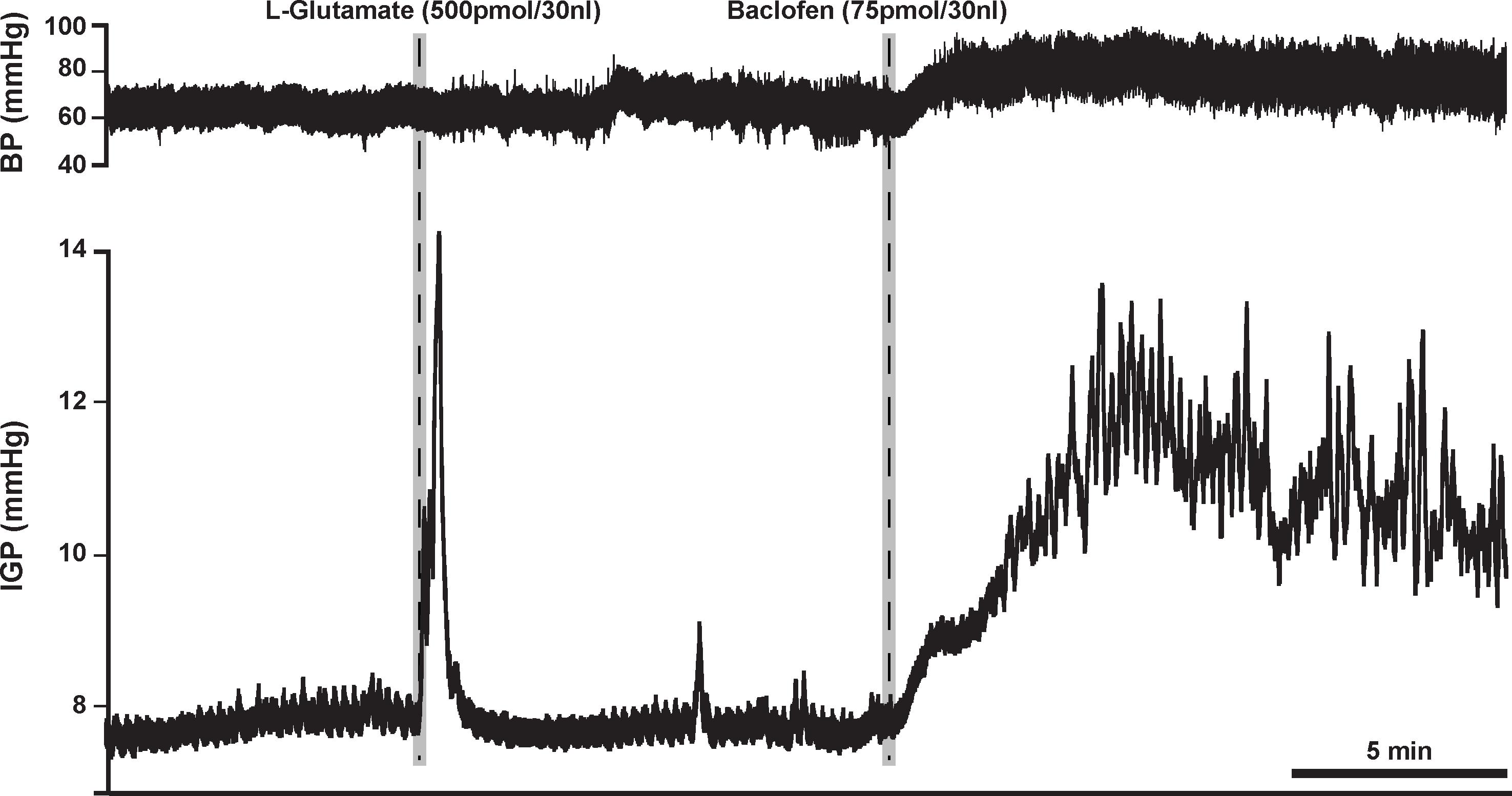 robaxin backorder