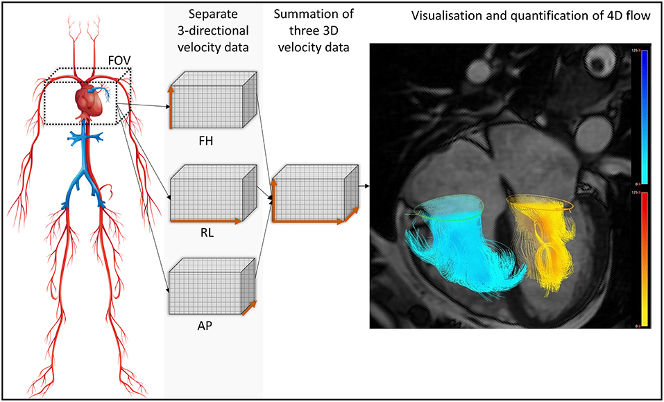 Reproducibility of 4D cardiac computed tomography feature tracking