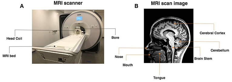 Figure 1 - What do the MRI scanner and the images that it takes look like?