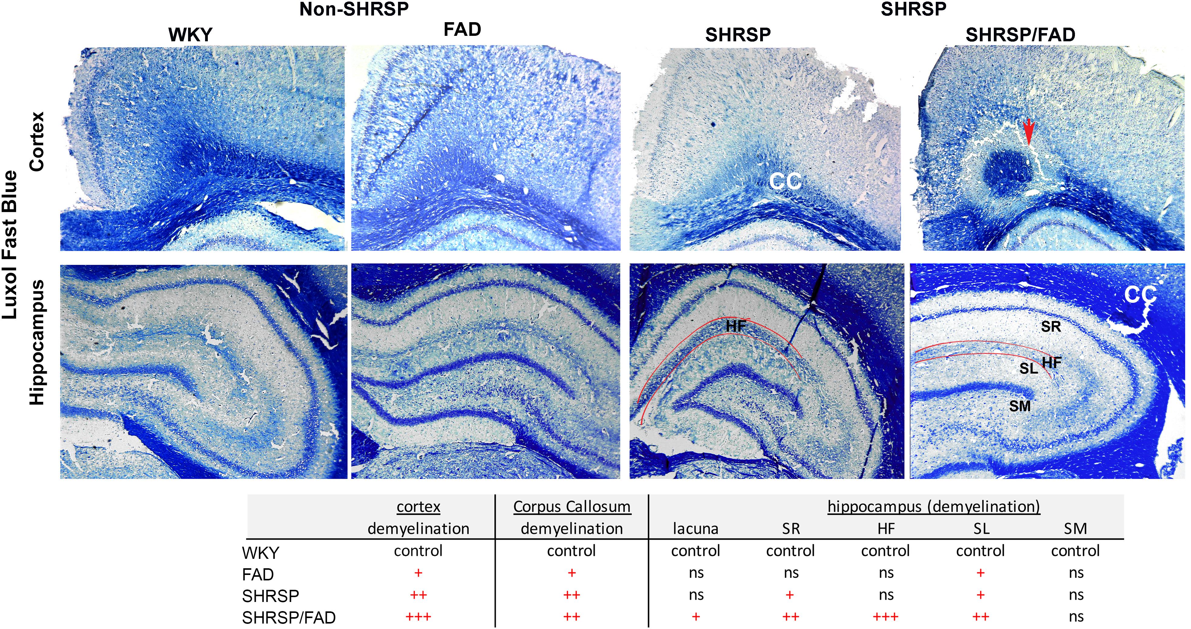 Frontiers  Striatal fibrinogen extravasation and vascular degeneration  correlate with motor dysfunction in an aging mouse model of Alzheimer's  disease