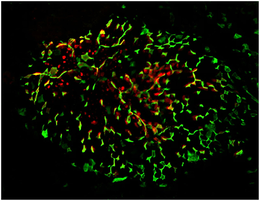 Antigen Select: Enteric Select – Lake Immunogenics