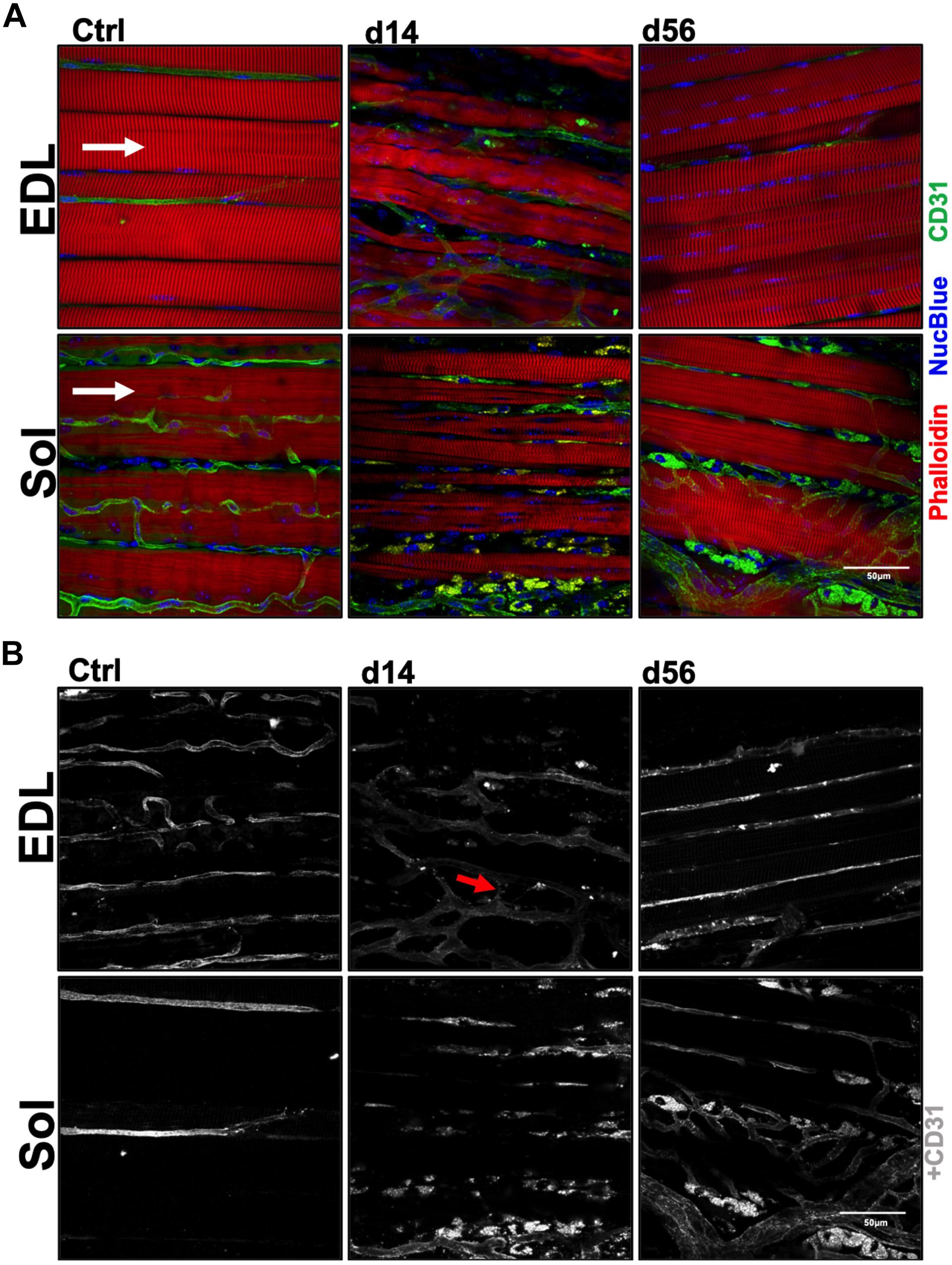 Frontiers Temporal Association Between Ischemic Muscle Perfusion Recovery And The Restoration Of Muscle Contractile Function After Hindlimb Ischemia Physiology