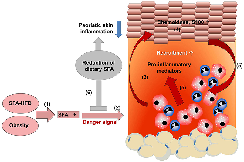 plaque psoriasis inflammatory disease)