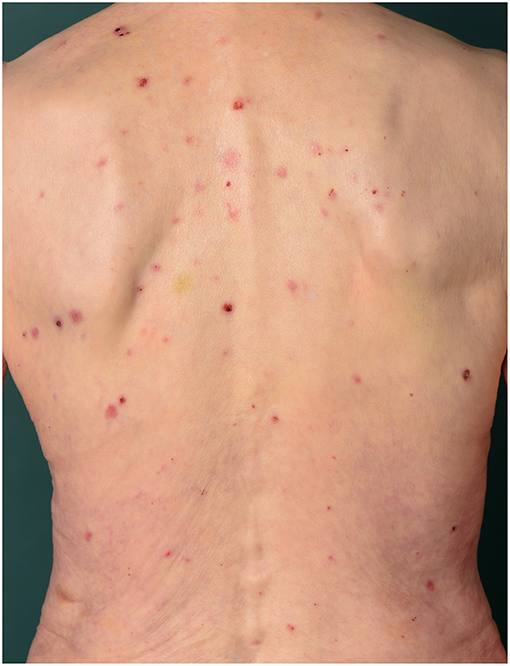 Skin rash: Causes, 71 pictures of symptoms, and treatments