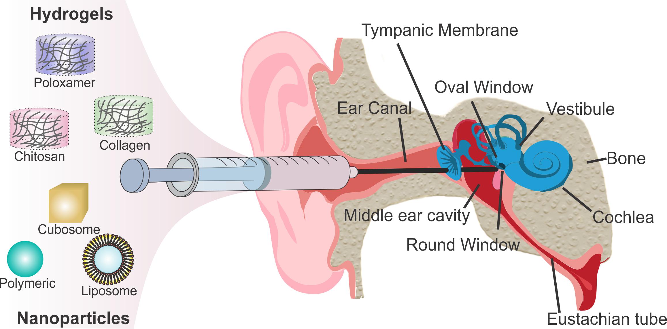 Figure 1. Scheme of intratympanic injection of biomaterials to the round wi...