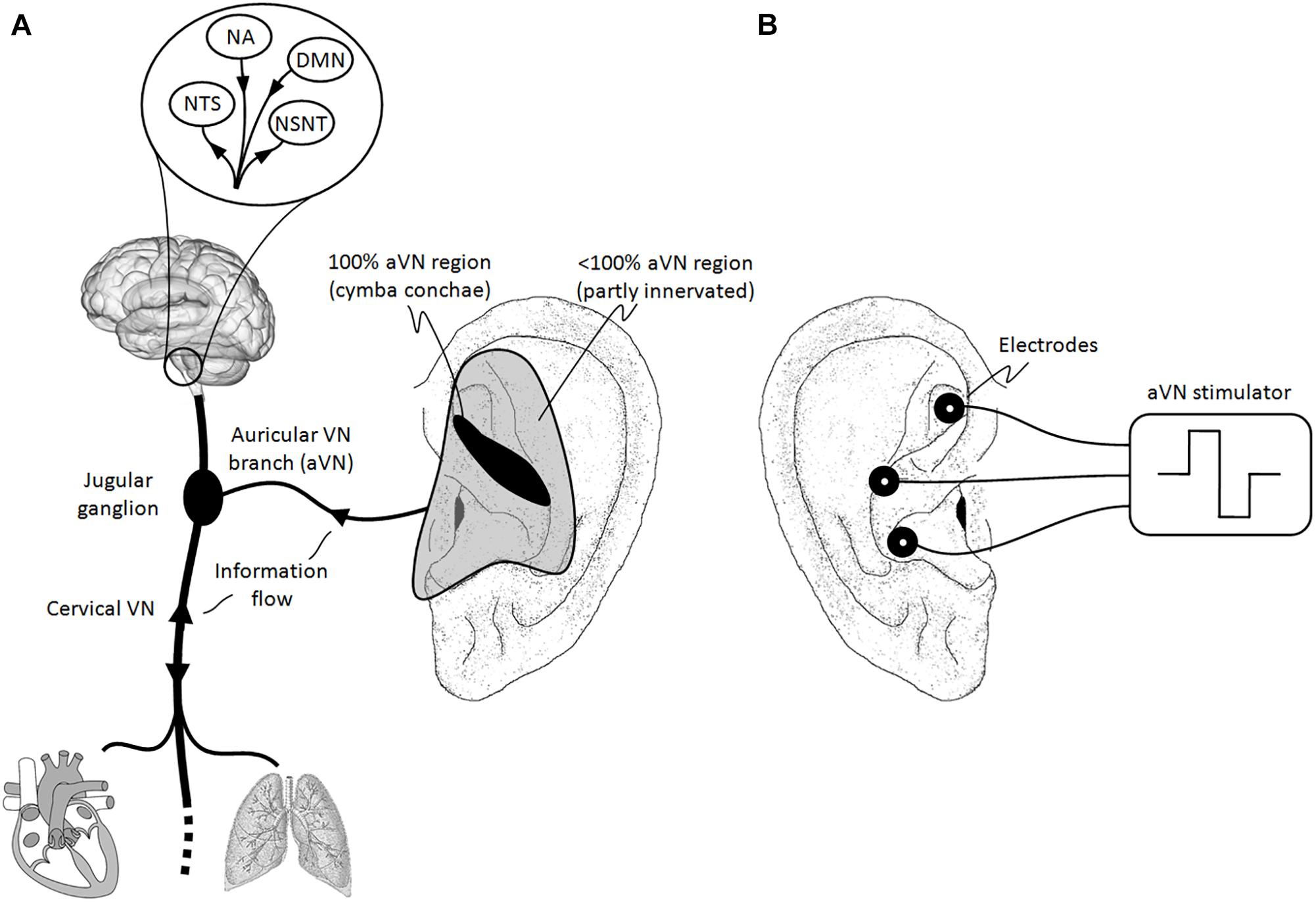 Transcutaneous Electrical Nerve Stimulation Archives - Diversified Health  Clinic