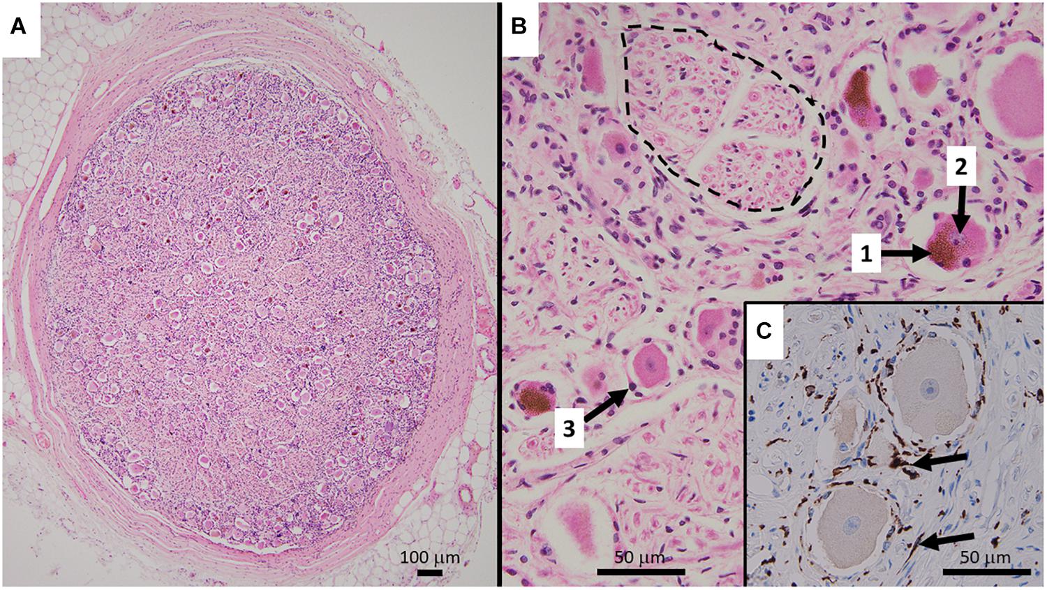 the dorsal root ganglia consist mainly of