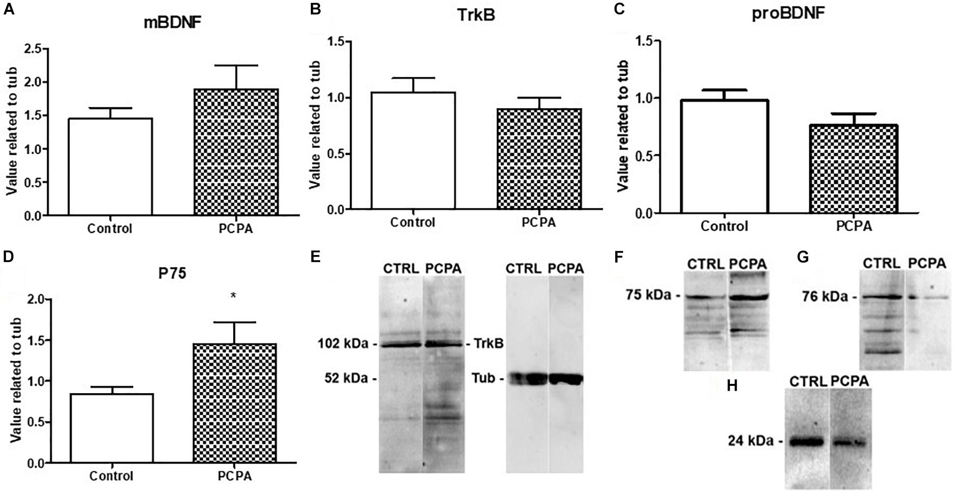 Frontiers | Differential Hippocampal Expression of BDNF Isoforms and Receptors Under Diverse Configurations of the Serotonergic System in a Mice Model of Increased Neuronal Survival | Cellular Neuroscience