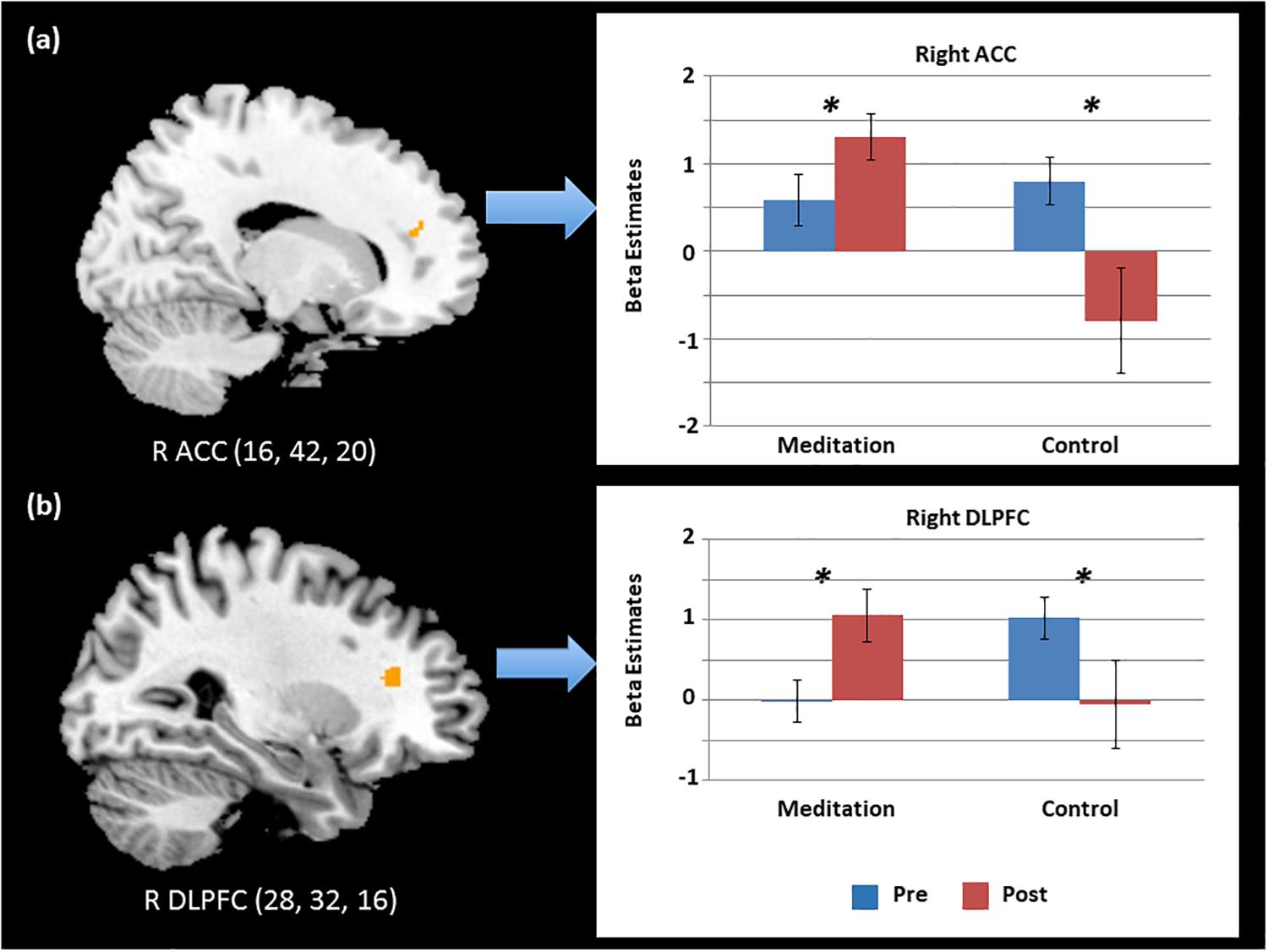 Тест бай. Executive Control Network[. Posner Peterson three attentional Networks. Dorsolateral Cortex in Mice.